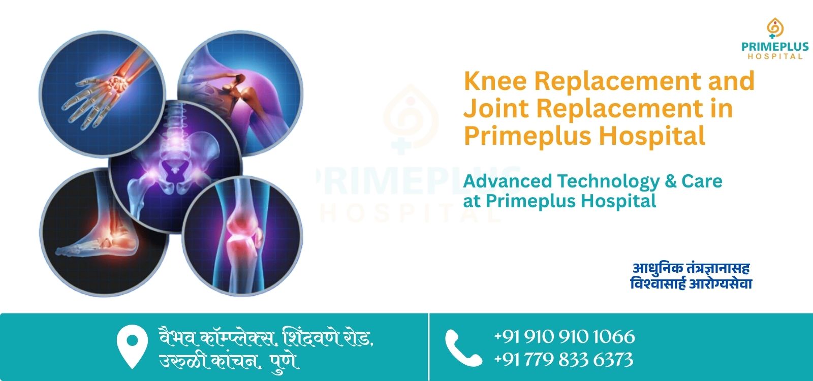 Robotic Knee Replacement & Joint Replacement in Uruli Kanchan, Pune: Advanced Care at Primeplus Hospital